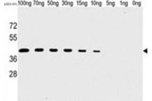 Western Blotting (WB) image for anti-Tyr/ser Protein Phosphatase antibody (ABIN2995280) (Tyr/ser Protein Phosphatase Antikörper)