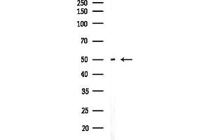 Western blot analysis of lysates from Hela cells(starvation,24h treatment), using NARFL Antibody at 1/1000 dilution.