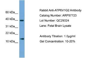 Western Blotting (WB) image for anti-ATPase, H+ Transporting, Lysosomal 13kDa, V1 Subunit G2 (ATP6V1G2) (Middle Region) antibody (ABIN2787359)