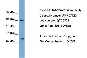 WB Suggested Anti-ATP6V1G2  Antibody Titration: 0. (ATP6V1G2 Antikörper  (Middle Region))