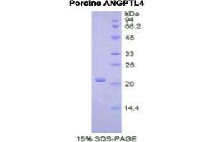 SDS-PAGE analysis of Pig ANGPTL4 Protein.