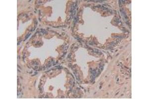 DAB staining on IHC-P; Samples: Human Prostate Gland Tissue (TLR5 Antikörper  (AA 693-858))