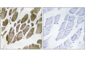 Immunohistochemistry analysis of paraffin-embedded human skeletal muscle tissue, using NMU Antibody. (Neuromedin U Antikörper  (AA 125-174))