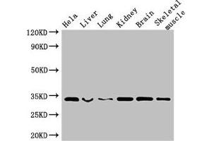 Western Blot Positive WB detected in: Hela whole cell lysate, Mouse liver tissue, Mouse lung tissue, Mouse kidney tissue, Mouse brain tissue, Mouse skeletal muscle tissue All lanes: CNN2 antibody at 2.