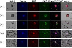 Immunofluorescence (Paraffin-embedded Sections) (IF (p)) image for anti-Keratin 17 (KRT17) antibody (ABIN2855697)