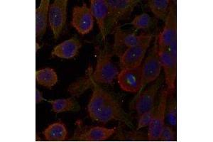 Immunofluorescence staining of methanol-fixed HeLa cells using LC3A /Apg-8 antibody (E021402, Red) (MAP1LC3A Antikörper)