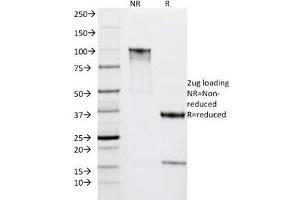 SDS-PAGE Analysis of Purified, BSA-Free HLA-DR Antibody (clone IPO-10).