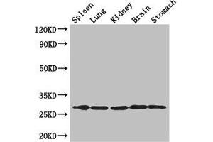 Western Blot Positive WB detected in: Mouse spleen tissue, , Mouse lung tissue, Mouse kidney tissue, Mouse brain tissue, Mouse stomach tissue All lanes: RTP3 antibody at 3 μg/mL Secondary Goat polyclonal to rabbit IgG at 1/50000 dilution Predicted band size: 28 kDa Observed band size: 28 kDa