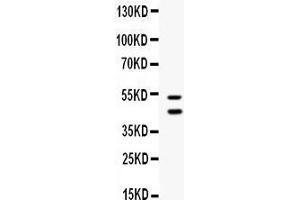 Western blot analysis of EPCR/CD201 expression in A549 whole cell lysates (lane 1).