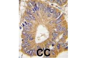 Immunohistochemistry (Paraffin-embedded Sections) (IHC (p)) image for anti-Eukaryotic Translation Initiation Factor 4E Binding Protein 1 (EIF4EBP1) (AA 48-77) antibody (ABIN388707)