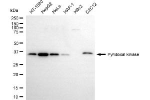 anti-Pyridoxal Kinase (PDXK) antibody