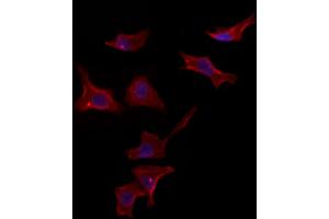 anti-Perilipin 3 (PLIN3) antibody