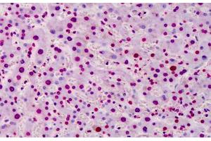 Human Liver: Formalin-Fixed, Paraffin-Embedded (FFPE) (Poly-ADP-Ribose Antikörper)