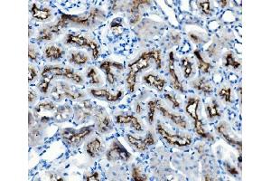 IHC analysis of ATG7 using anti-ATG7 antibody (ABIN7603109).