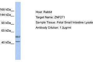 Host: Rabbit Target Name: ZNF271 Sample Type: Fetal Small Intestine lysates Antibody Dilution: 1. (ZNF271 Antikörper  (Middle Region))