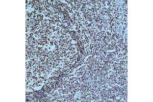Immunohistochemical analysis of Cleaved PARP1 staining in human tonsil formalin fixed paraffin embedded tissue section. (PARP1 Antikörper  (cleaved))