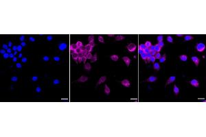 Immunocytochemical staining of Hela cells with RALBP1 antibody (ABIN7800126), 1:1,000). (Rekombinanter RALBP1 Antikörper)