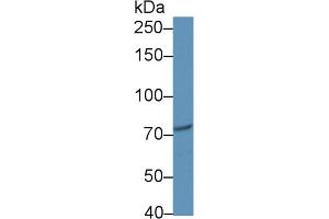 Western blot analysis of Human jurkat cell lysate, using Human CIP2A Antibody (1 µg/ml) and HRP-conjugated Goat Anti-Rabbit antibody ( (KIAA1524 Antikörper  (AA 230-560))