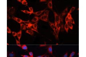 Immunofluorescence analysis of NIH/3T3 cells using SLC29A1 Polyclonal Antibody at dilution of 1:100. (SLC29A1 Antikörper)
