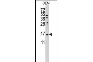Western Blotting (WB) image for anti-LSM1 Homolog, U6 Small Nuclear RNA Associated (LSM1) (AA 103-133), (C-Term) antibody (ABIN389386)