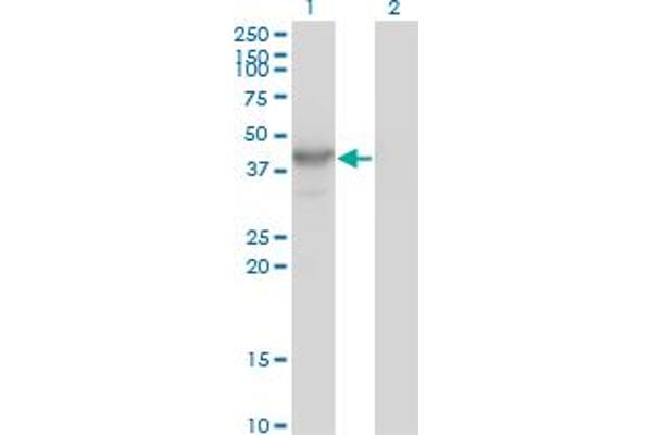 HDAC8 Antikörper  (AA 1-377)