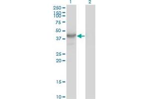 HDAC8 antibody  (AA 1-377)