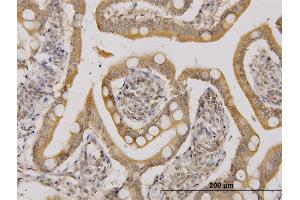 Immunoperoxidase of monoclonal antibody to UBE2D2 on formalin-fixed paraffin-embedded human small Intestine. (UBE2D2 Antikörper  (AA 1-94))