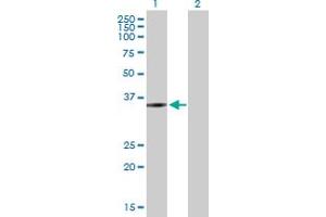 Western Blot analysis of ZMYND12 expression in transfected 293T cell line by ZMYND12 MaxPab polyclonal antibody. (ZMYND12 Antikörper  (AA 1-365))