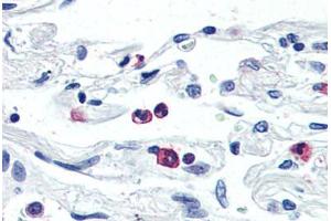 Anti-LGR6 antibody  ABIN1049008 IHC staining of human neutrophils.