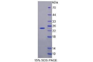 SDS-PAGE analysis of Human HPCAL4 Protein.