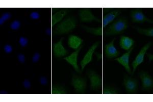 Detection of GLa in Human Hela cell using Polyclonal Antibody to Galactosidase Alpha (GLa) (GLA Antikörper  (AA 1-80))