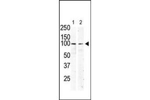 Image no. 1 for anti-Mast/stem Cell Growth Factor Receptor (KIT) (N-Term) antibody (ABIN359890) (KIT Antikörper  (N-Term))
