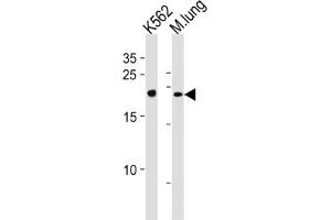 Western Blotting (WB) image for anti-Core-Binding Factor, beta Subunit (CBFB) antibody (ABIN3002868) (CBFB Antikörper)