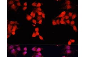 Immunofluorescence analysis of HeLa cells using ENO3 Polyclonal Antibody at dilution of 1:100. (ENO3 Antikörper)
