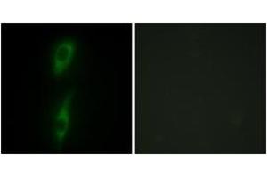 Immunofluorescence analysis of HeLa cells, using ACVL1 Antibody. (ACVRL1 Antikörper  (AA 196-245))