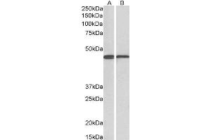 Antibody (0. (ACAT1 Antikörper  (AA 253-266))