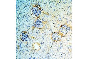 IHC analysis of ANXA3 using anti-ANXA3 antibody (ABIN6719269). (Annexin A3 Antikörper  (AA 23-323))