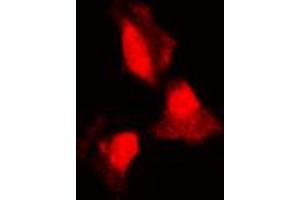 Immunofluorescent analysis of SGK1 staining in HepG2 cells. (SGK1 Antikörper  (Center))