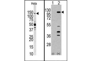 Image no. 1 for anti-Phosphoinositide-3-Kinase, Catalytic, gamma Polypeptide (PIK3CG) (C-Term) antibody (ABIN360712) (PIK3 gamma Antikörper  (C-Term))
