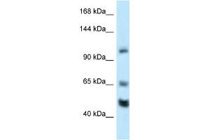WB Suggested Anti-Rest Antibody Titration: 1. (REST Antikörper  (Middle Region))
