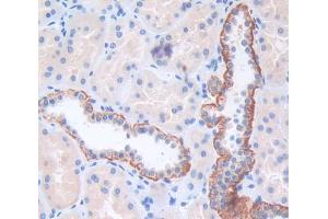 IHC-P analysis of Human Tissue, with DAB staining. (ITGA2 Antikörper  (AA 678-894))