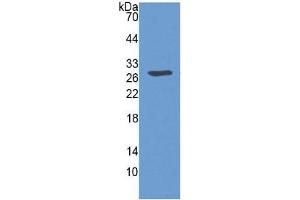 Western Blotting (WB) image for serpin Peptidase Inhibitor, Clade B (Ovalbumin), Member 3 (SERPINB3) ELISA Kit (ABIN6574275)