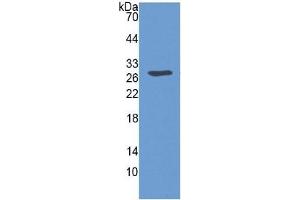 WB of Protein Standard: different control antibodies against Highly purified E. (SERPINB3 ELISA Kit)