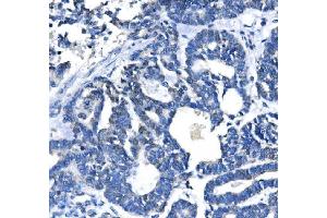 IHC analysis of METTL3 using anti-METTL3 antibody (ABIN7602808).