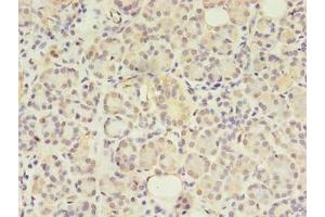Immunohistochemistry of paraffin-embedded human pancreatic tissue using ABIN7144550 at dilution of 1:100 (GIT2 Antikörper  (AA 1-603))