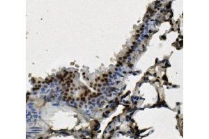 IHC analysis of hnRNP D/AUF1/HNRNPD using anti-hnRNP D/AUF1/HNRNPD antibody (ABIN7602591).