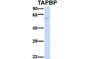 Western Blotting (WB) image for anti-TAP Binding Protein (Tapasin) (TAPBP) (Middle Region) antibody (ABIN2782219)