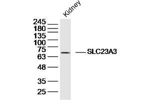 Mouse kidney lysates probed with SLC23A3 Polyclonal Antibody, Unconjugated  at 1:300 dilution and 4˚C overnight incubation. (SLC23A3 Antikörper  (AA 201-300))