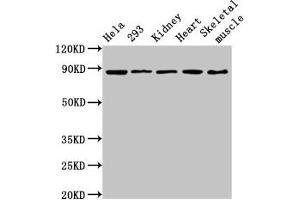Western Blot Positive WB detected in: Hela whole cell lysate, 293 whole cell lysate, Rat kidney tissue, Mouse heart tissue, Mouse skeletal muscle tissue All lanes: SEMA3A antibody at 3. (SEMA3A Antikörper  (AA 357-445))