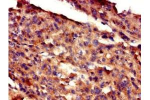 Immunohistochemistry (IHC) image for anti-Growth Arrest-Specific 7 (GAS7) (AA 1-153) antibody (ABIN7154490)